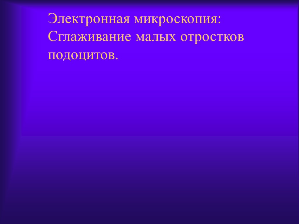 Электронная микроскопия: Сглаживание малых отростков подоцитов.